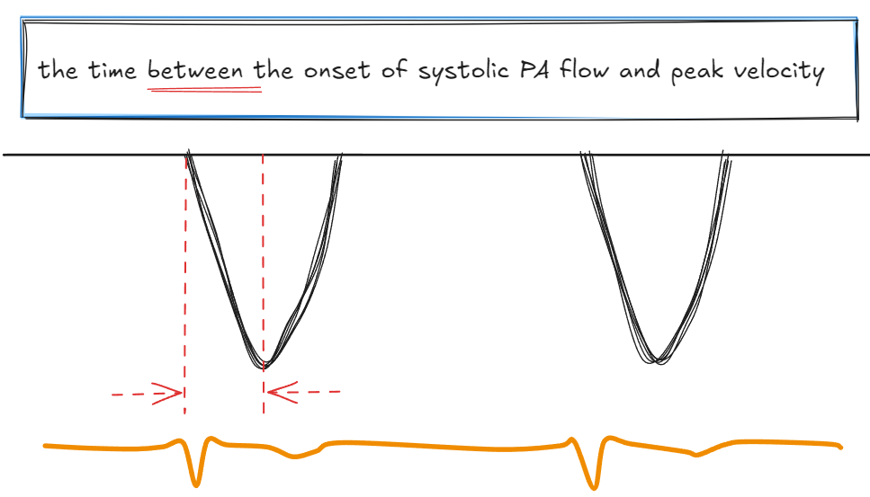 Doppler waveform showing PAAT measurement